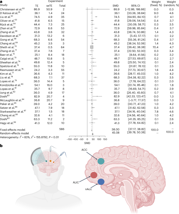 Neuromodulation for treatment-resistant obsessive–compulsive disorder: a systematic review, meta-analysis and network analysis – Nature Mental Health