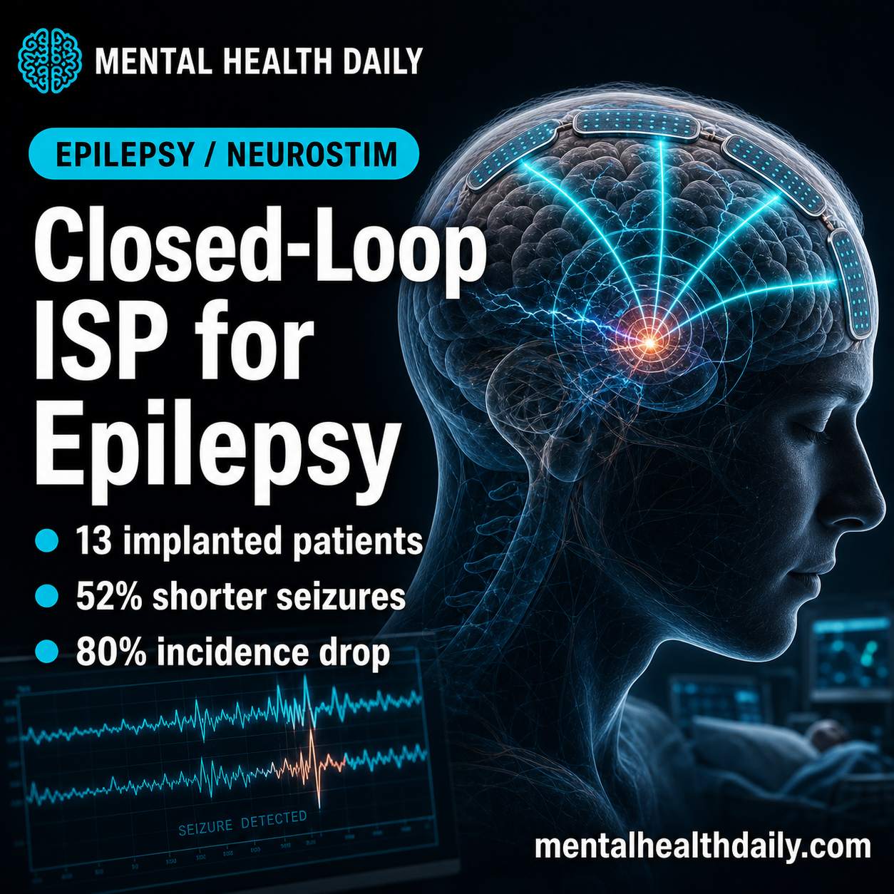 Closed-Loop Subgaleal ISP Reduced Epilepsy Seizure Incidence 80%