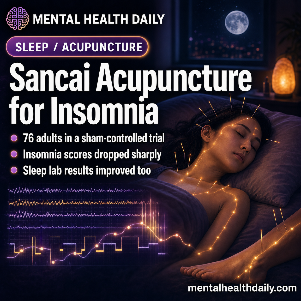 Sancai Acupuncture for Primary Insomnia: 13-Point ISI Drop vs. Sham