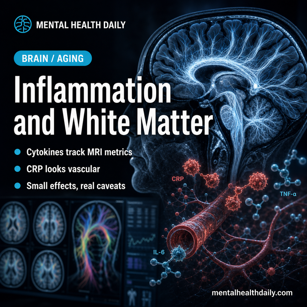 Inflammation Tracks White-Matter MRI in Aging Adults