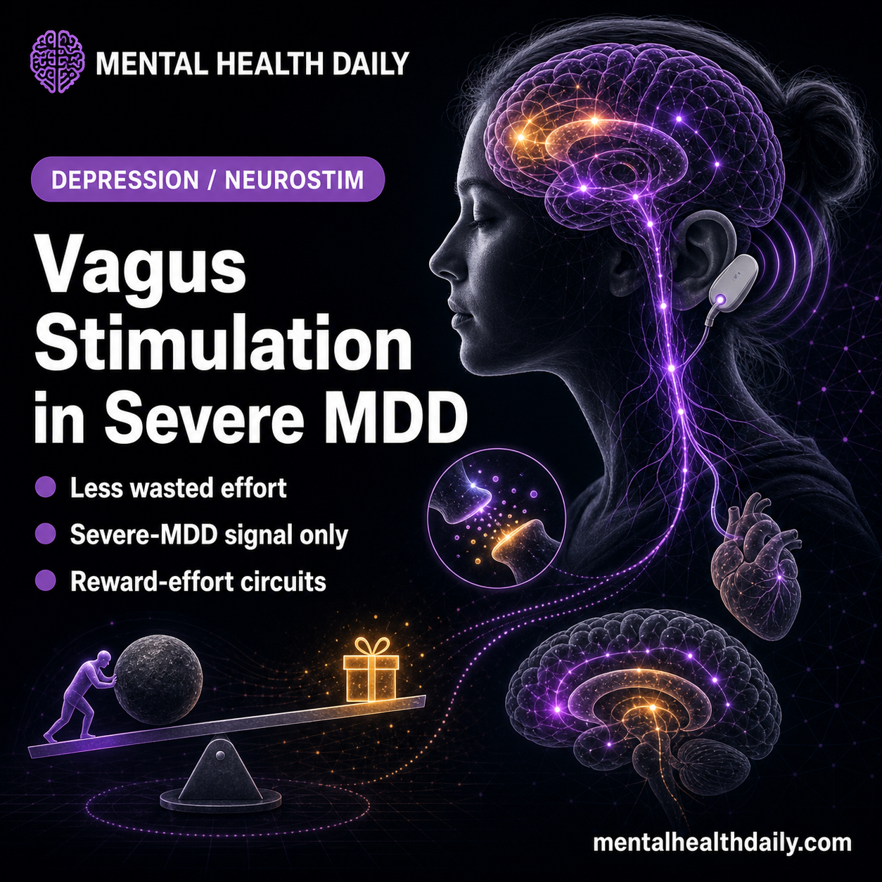 tVNS Alters Effort and Reward Decisions in Severe Depression