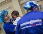 Understanding the challenges of living with a cleft lip | Letters