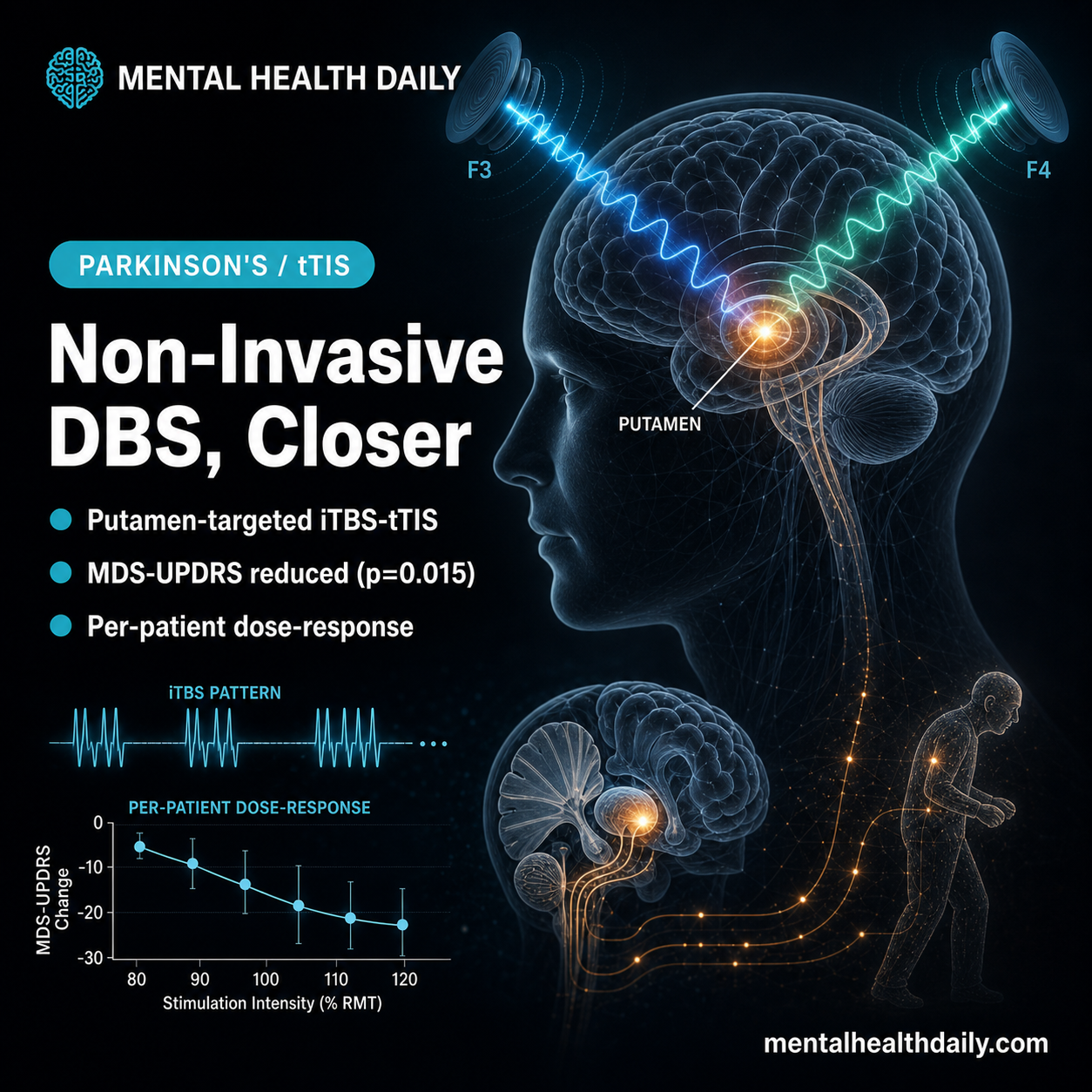 Transcranial Temporal Interference Stimulation (tTIS) May Improve Parkinson’s Motor Symptoms