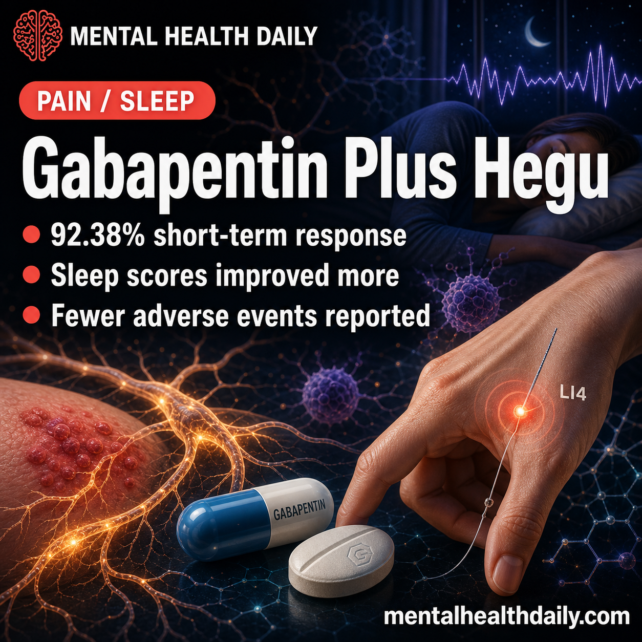 gabapentin-plus-hegu-embedding:-92%-postherpetic-neuralgia-response