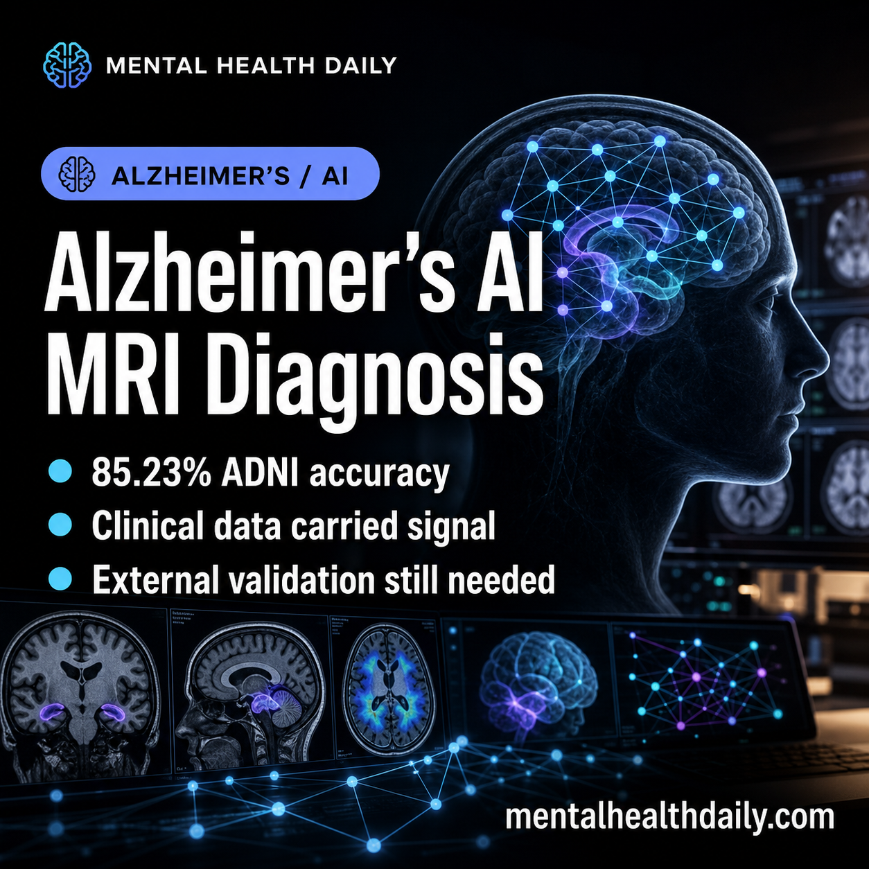 Alzheimer’s AI MRI Diagnosis: ANA-GNN Reaches 85.23% Accuracy in ADNI