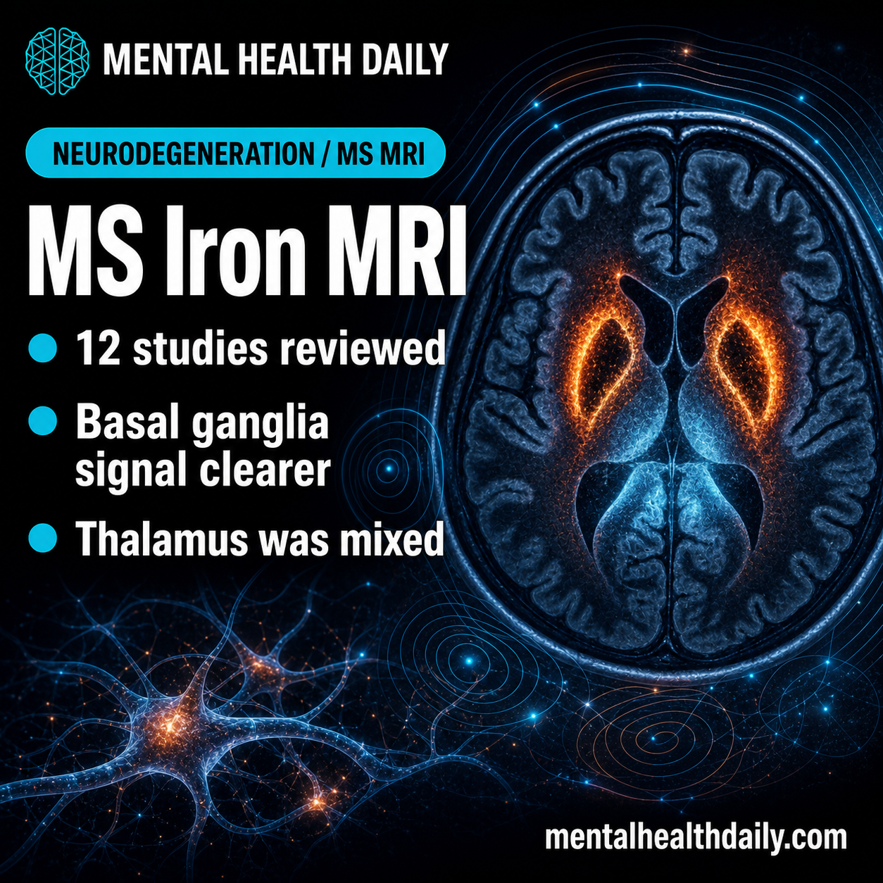 Multiple Sclerosis Iron MRI Linked to Cognitive Impairment in 12 Studies