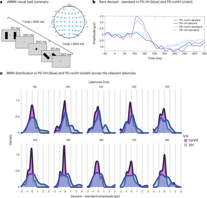 deviations-in-effective-connectivity-explain-different-hallucination-subtypes-in-parkinson’s-disease-psychosis-–-nature-mental-health