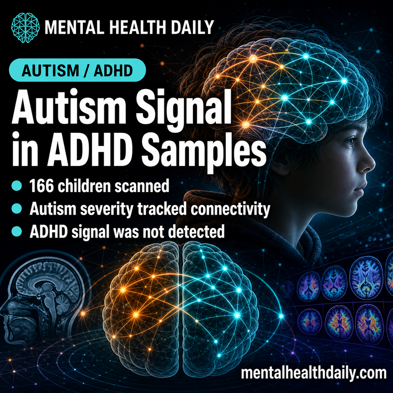 Autism vs. ADHD Connectome Study: Frontal-DMN Signal Tracks Autism Severity