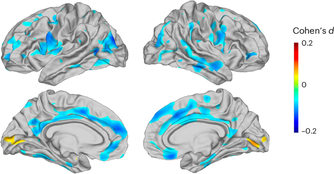 vertex-wise-cortical-abnormalities-in-major-depressive-disorder-from-64-cohorts-from-the-direct-and-enigma-mdd-consortia-–-nature-mental-health
