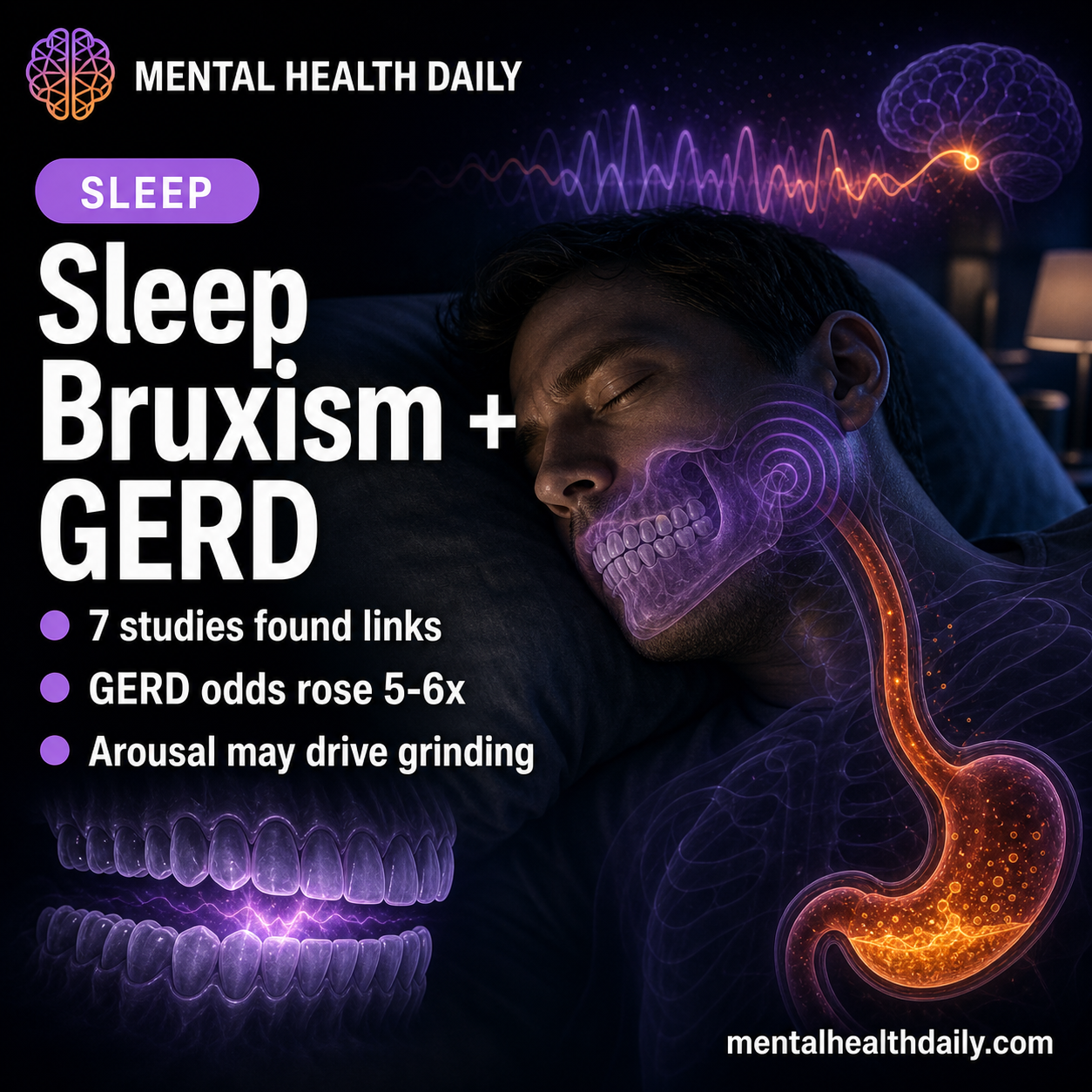sleep-bruxism-and-gerd:-7-studies-linked-tooth-grinding-with-reflux