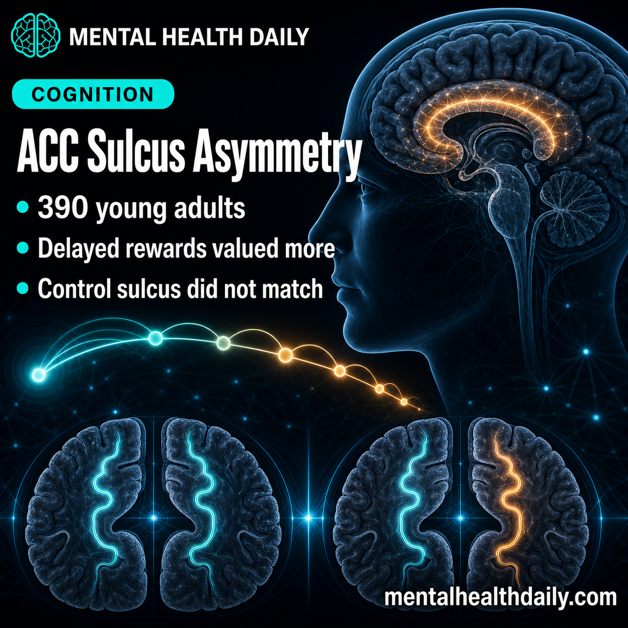Anterior Cingulate Sulcus Asymmetry Linked to Lower Delay Discounting