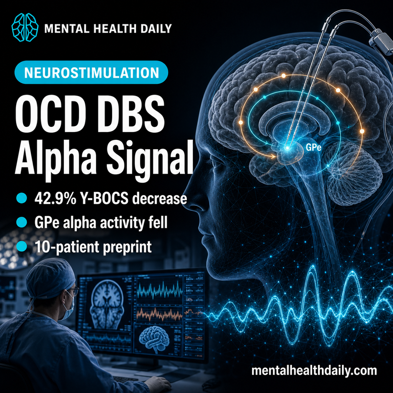 ocd-dbs-reduced-y-bocs-42.9%-as-gpe-alpha-activity-decreased