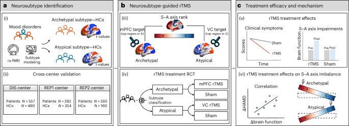 neurobiomarker-guided-neuromodulation-for-youth-with-major-depressive-episodes:-a-double-blind-randomized-trial-–-nature-mental-health