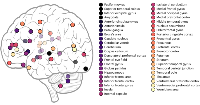 decoding-the-temporal-dynamics-of-face-specific-neural-representations-in-autism-–-nature-mental-health