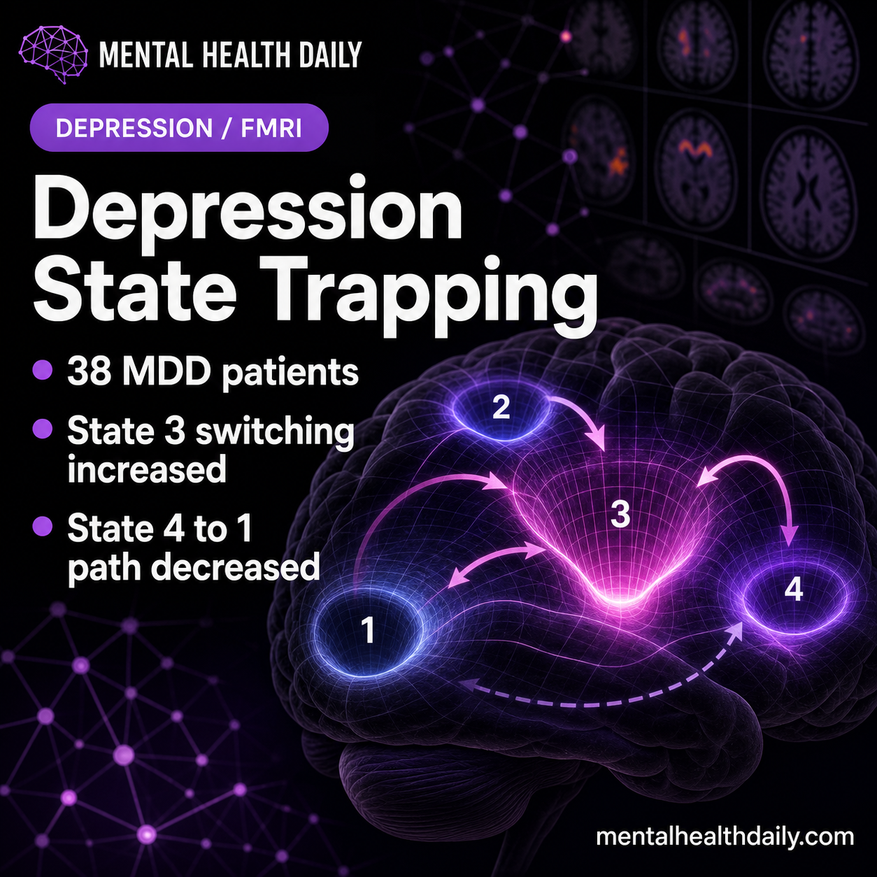 Depression Brain Energy Landscape Showed State 3 Trapping in MDD